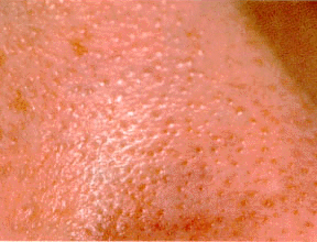 �j�L�r�̂ł��͂���